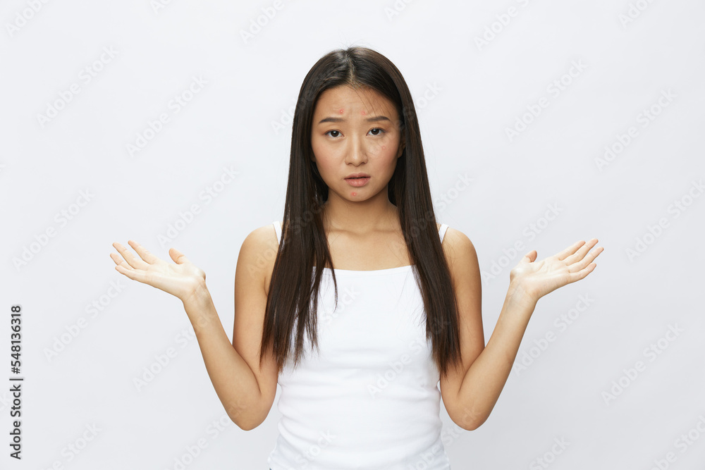 Asian woman facial skin problems, acne and inflammation, red rashes and allergies, chicken pox, sadness from rashes. Facial skin care concept for diseases and nerves Asian woman facial skin problems, acne and inflammation, red rashes and allergies, chicken pox, sadness from rashes. Facial skin care concept for diseases and nerves