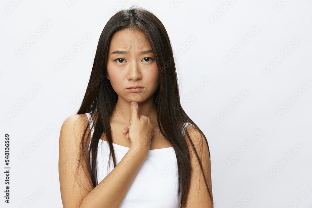 Asian woman hand signals, finger pointing facial skin problems, acne and inflammation, red rash and allergies, chicken pox, sadness from rashes. Facial skin care concept for diseases and nerves Asian woman hand signals, finger pointing facial skin problems, acne and inflammation, red rash and allergies, chicken pox, sadness from rashes. Facial skin care concept for diseases and nerves