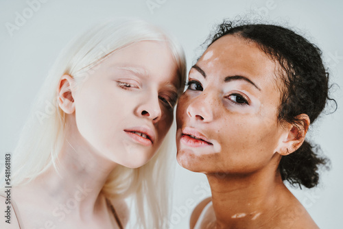 Bilde på lerret Group of multiethnic women with different kind of skin posing together in studio