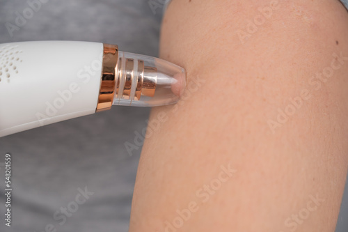 Close-up of a vacuum skin cleaner at home.