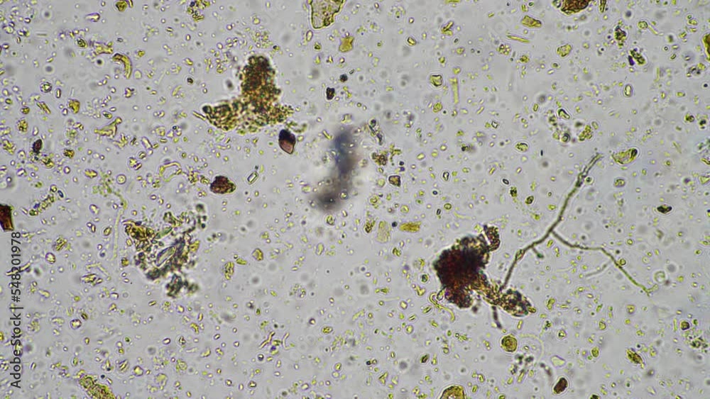 soil microbes organisms in a soil and compost sample, fungus and fungi ...