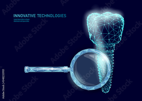 Molar tooth dental implant 3d low poly geometric model. Dentistry innovation future technology titan metal thread. Medical health science polygonal point line vector illustration