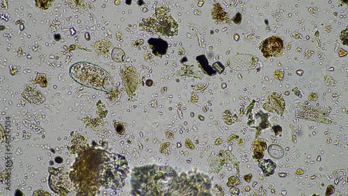 soil microbes organisms in a soil and compost sample, fungus and fungi and under the microscope in regenerative agriculture. in australia. photo