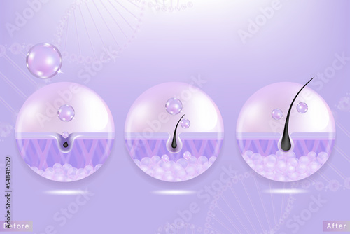 Hyaluronic acid before and after hair and skin solutions ad. purple collagen serum drop into skin cells with cosmetic advertising background ready to use, illustration vector.