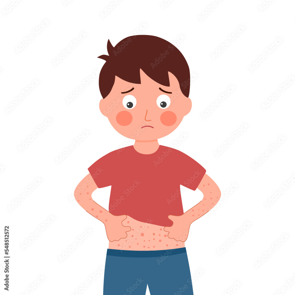 Boy children scratching body. Kids suffering from strong allergy skin itchy symptom in flat design. Red rash skin irritation. Boy children scratching body. Kids suffering from strong allergy skin itchy symptom in flat design. Red rash skin irritation.