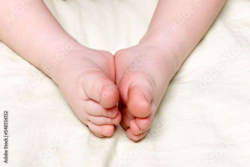 Children's legs close-up. The concept of children's diseases of the legs and skin, orthopedics photo