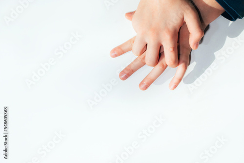 Children's hand with a wart on a white background. Papilomavirus. View from above