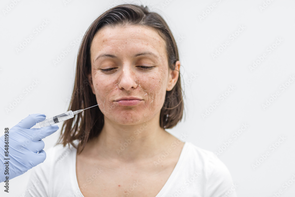 Photo of woman with dry skin and hand in medical glove with injection. Photo of woman with dry skin and hand in medical glove with injection.