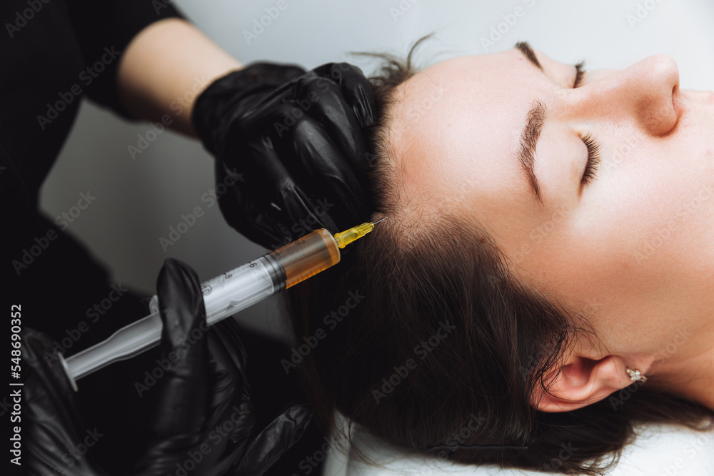 Plasma injection into the hair on a woman 's head .a cosmetologist ...