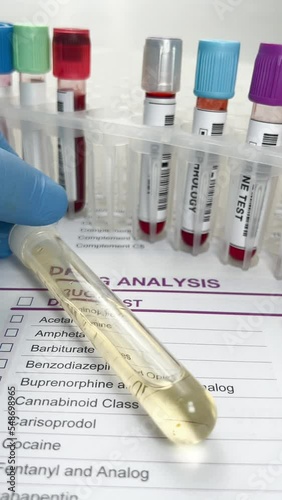 Doctor's hand with urinalysis and blood samples for drug test or alcohol over Medical report. Hand doctor holding a urine and blood tube test for analysis for doping or drugs photo