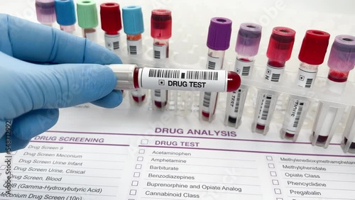 Hand doctor holding a urine and blood tube test for analysis for doping or drugs. Doctor's hand with urinalysis and blood samples for drug test or alcohol over Medical report