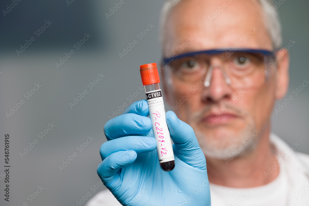 doctor or scientist is handling a blood test tube in front of a lab room doctor or scientist is handling a blood test tube in front of a lab room