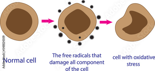 Oxidative stress. From normal cells, to oxidative stress and aggressive free radicals, to cell death.Educational and study content for students of biology, medicine and science.vector illustration.
 photo
