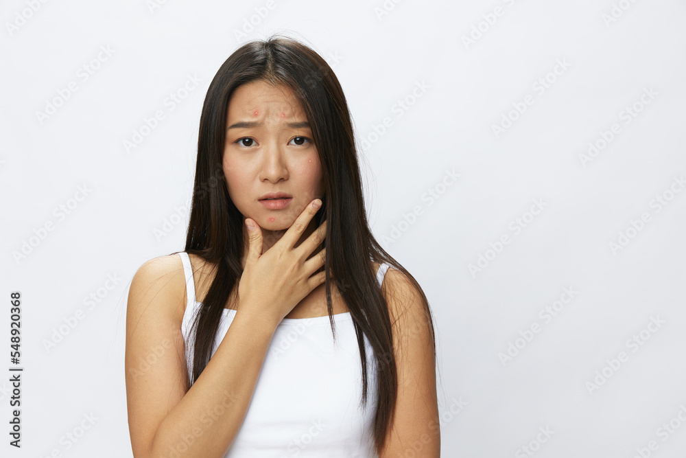 Asian woman hand signals, finger pointing facial skin problems, acne and inflammation, red rash and allergies, chicken pox, sadness from rashes. Facial skin care concept for diseases and nerves Asian woman hand signals, finger pointing facial skin problems, acne and inflammation, red rash and allergies, chicken pox, sadness from rashes. Facial skin care concept for diseases and nerves