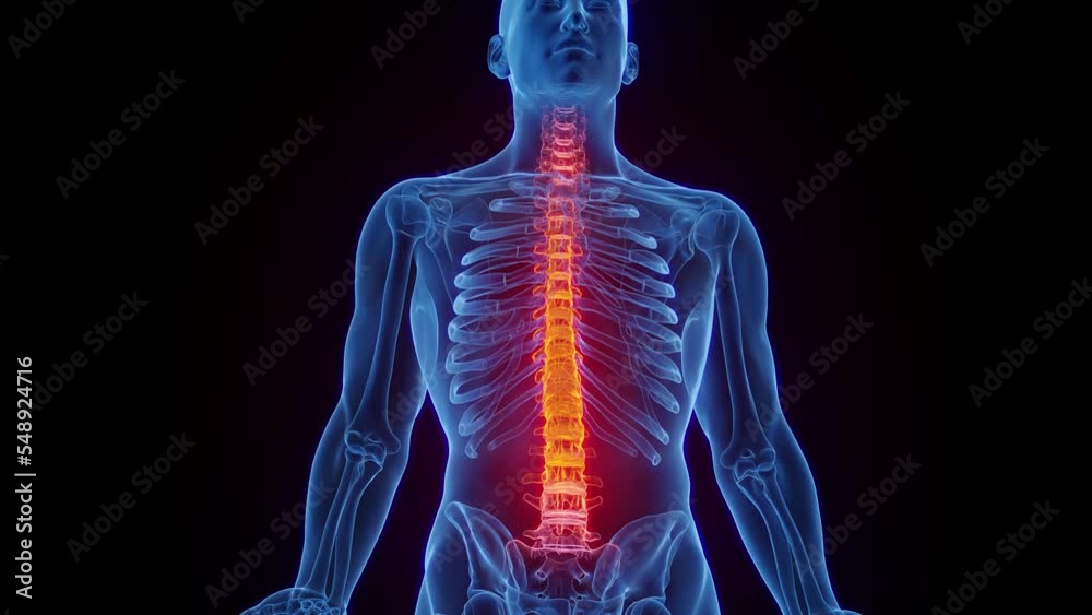3D rendered Medical Animation of a man's inflamed Spine 3D rendered Medical Animation of a man's inflamed Spine