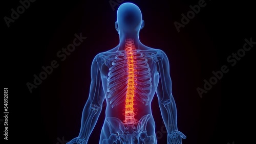 3D rendered Medical Animation of a man's inflamed spinal column. photo