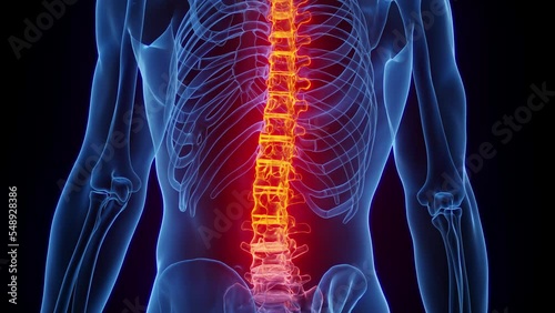 3D rendered Medical Animation of a man's inflamed spine up close