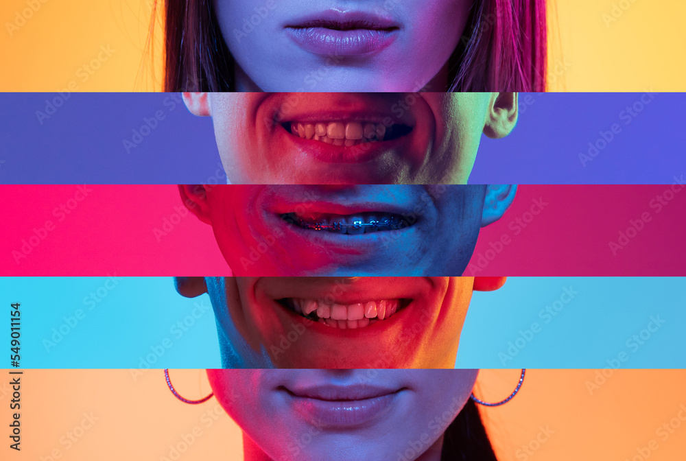 Collage of close-up male and female mouths and chins isolated on colored neon backgorund. Multicolored stripes. Emotions, facial expressions, dental health - obrazy, fototapety, plakaty 