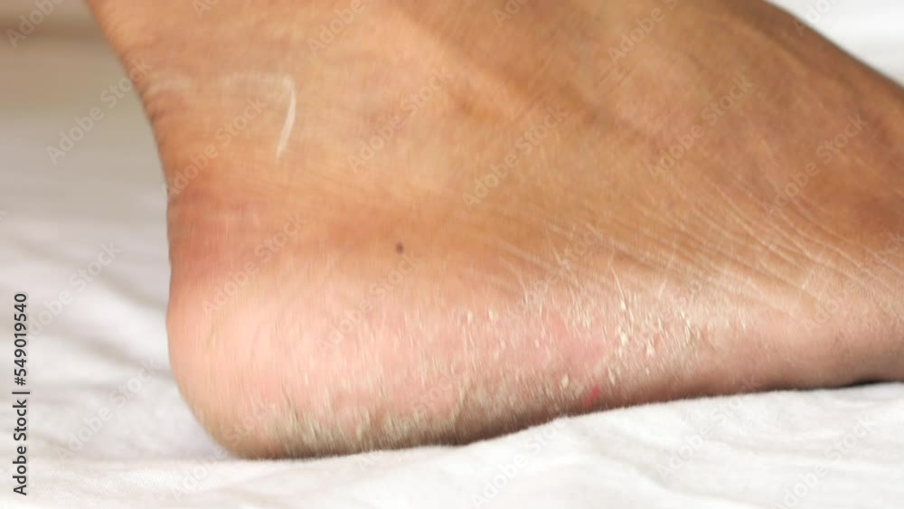 close up of young men dry feet on bed , close up of young men dry feet on bed ,