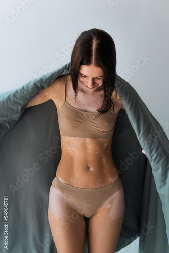 young woman with vitiligo skin condition standing in underwear and covering in blanket isolated on grey.