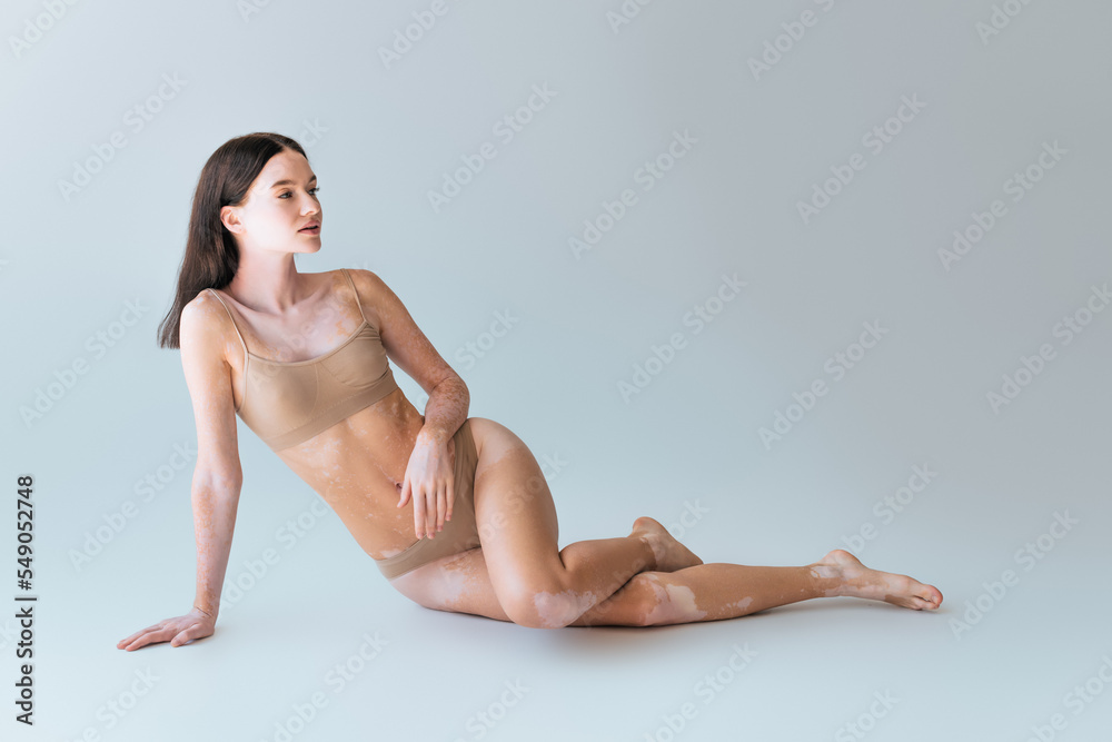 full length of brunette young woman with vitiligo sitting in beige lingerie on grey. full length of brunette young woman with vitiligo sitting in beige lingerie on grey.