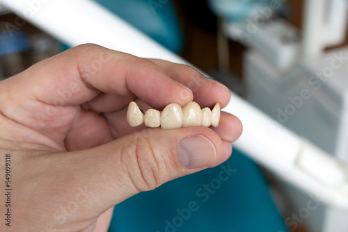 The dentist holds a ceramic  zirconium  bridge-shaped  non-removable dental prosthesis in his hand. Dental bridge. 
