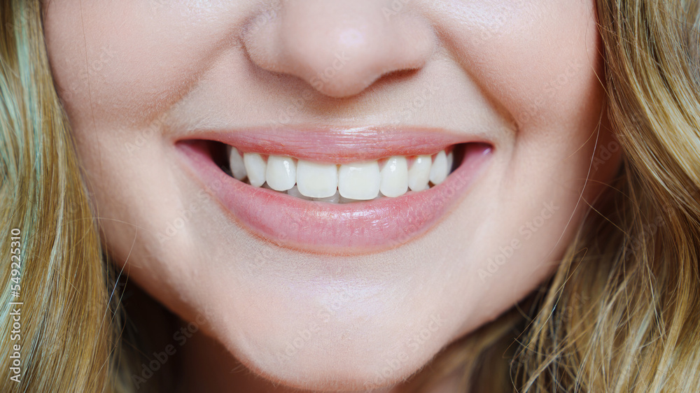 close-up. a woman's smile with bleached white teeth. close-up. a woman's smile with bleached white teeth.