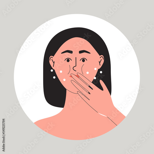 Young woman have problem with belching, she holding hand near her mouth. Burping girl. Funny flat vector medical illustration
