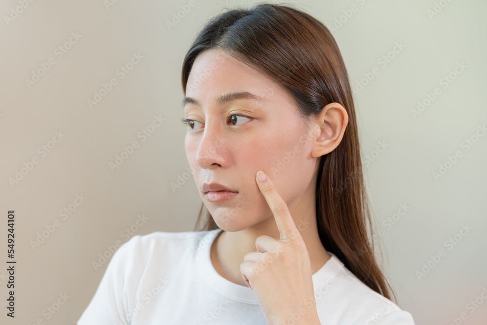 Dermatology, scratch asian young woman pointing on face, expression worry and itch, itchy allergy or allergic sensitive reaction, red spot or rash on facial. Beauty care from skin problem treatment. Dermatology, scratch asian young woman pointing on face, expression worry and itch, itchy allergy or allergic sensitive reaction, red spot or rash on facial. Beauty care from skin problem treatment.