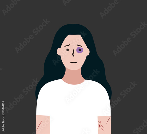 Depressed woman with black eye and scars suffering from Abuse and Bullying. Social problem, Violence, intimidation concept. Flat vector illustration for Landing page, banner, poster.