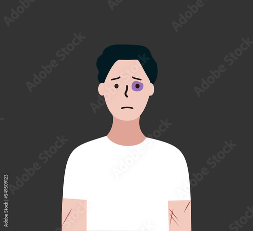 Depressed man with black eye and scars suffering from Abuse and Bullying. Social problem, Violence, intimidation concept. Flat vector illustration for Landing page, banner, poster.