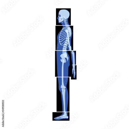 Set of X-Ray Skeleton Human body parts - hands, legs, chest, head, vertebra, pelvis, Bones adult people roentgen side view. 3D realistic flat blue color concept Vector illustration of medical anatomy