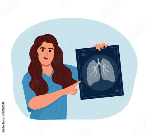 Smiling female doctor holds x-ray of lungs in hand to prevent asthma. World Asthma Day.Bronchial Asthma. Allergy, asthmatic. Inhalation drug. Bronchial asthma.