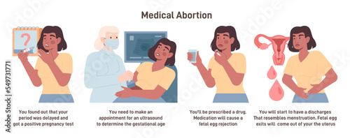 Canvastavla Medical abortion procedure and course of the process