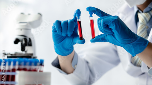 Lab assistant, a medical scientist, a chemistry researcher holds a glass tube through the blood sample, does a chemical experiment and examines a patient's blood sample. Medicine and research concept.