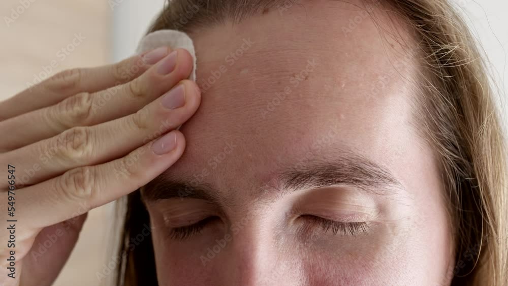 Close up face of man using cotton pad to apply skin care product on forehead. Close up face of man using cotton pad to apply skin care product on forehead.