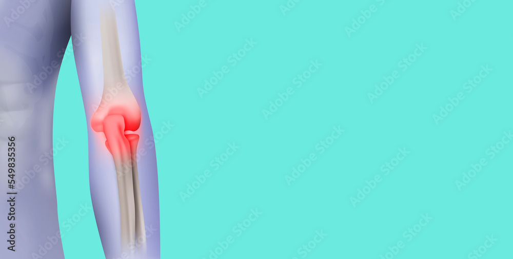 Elbow pain, joint pain, bad epicondyle, elbow arthritis, fracture
