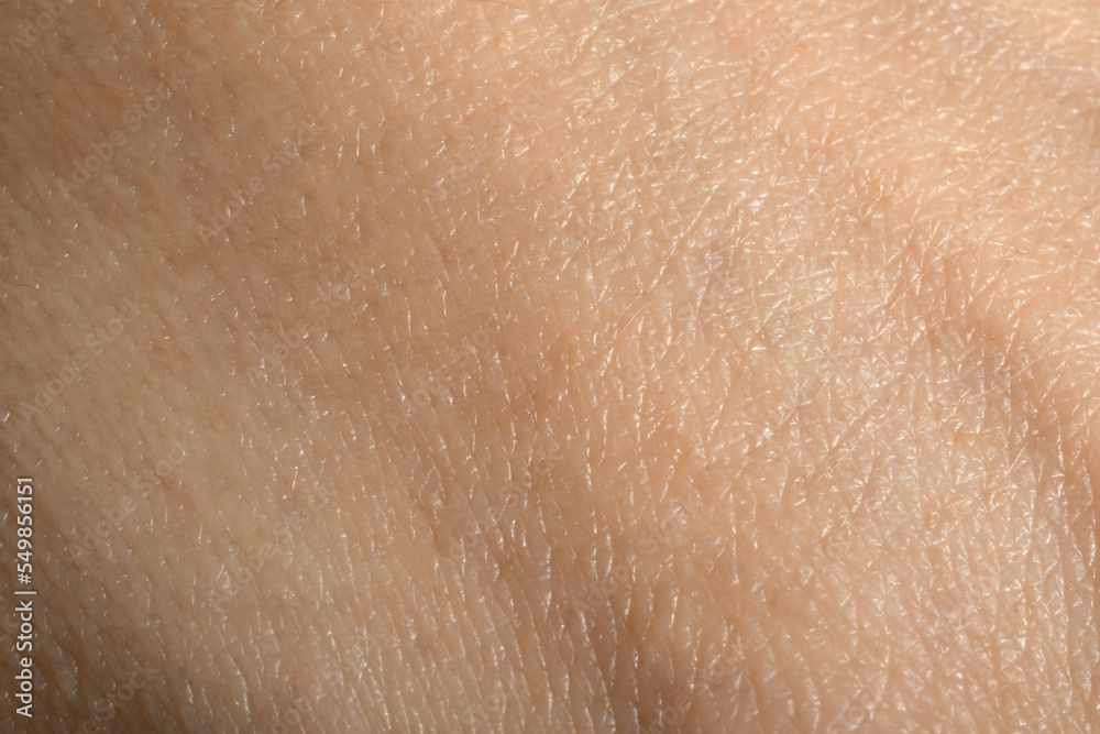 Closeup view of dry human skin as background Closeup view of dry human skin as background