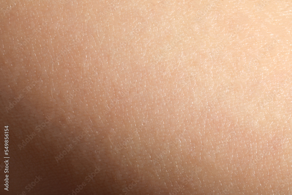 Fototapeta premium Closeup view of dry human skin as background
