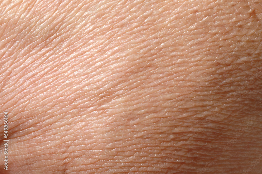 Fototapeta premium Closeup view of dry human skin as background