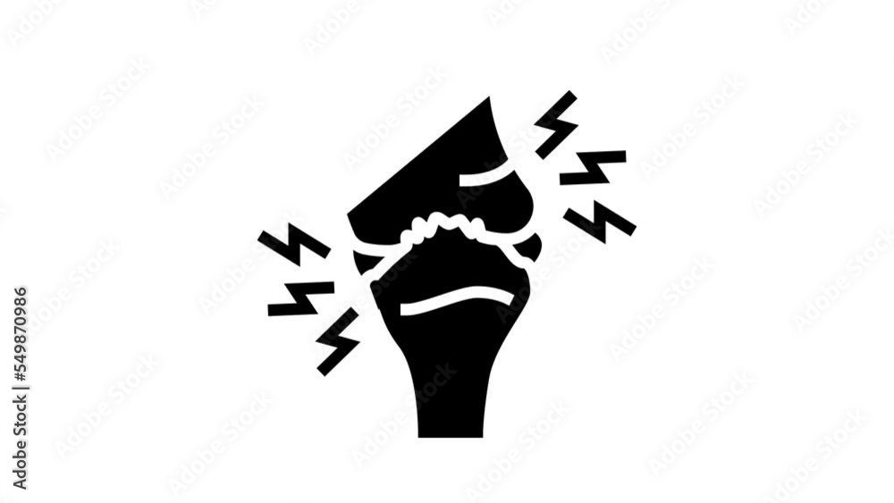 osteoarthritis health problem glyph icon animation osteoarthritis health problem glyph icon animation