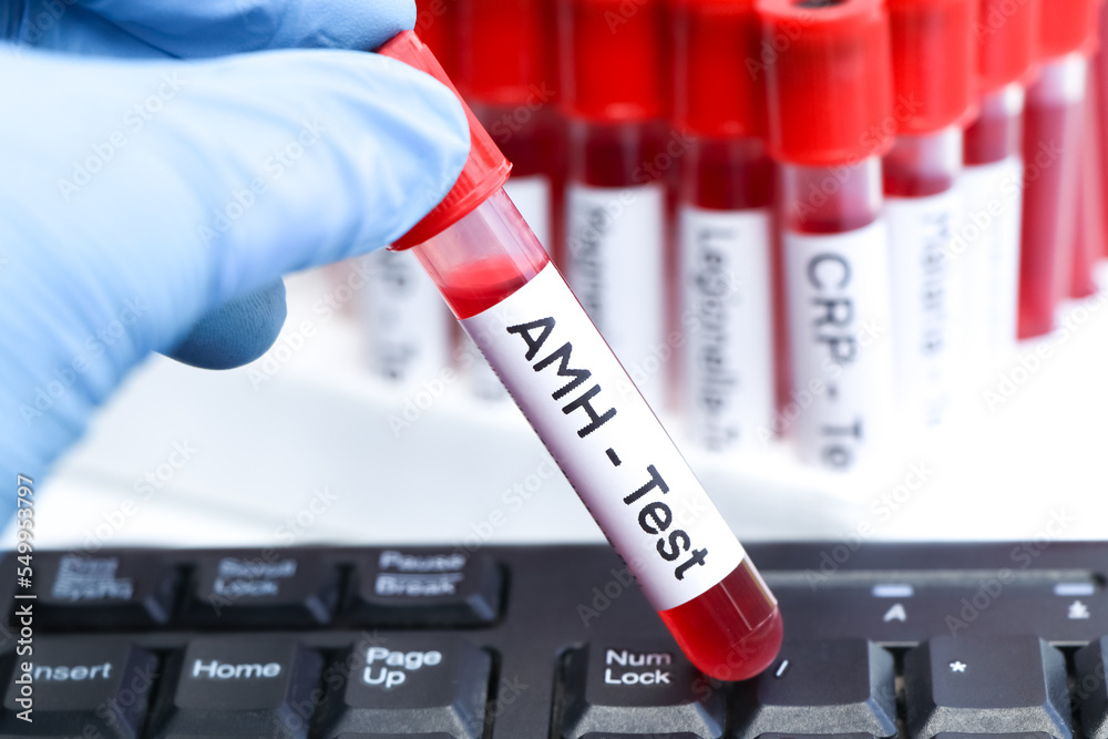 Fototapeta premium AMH test to look for abnormalities from blood