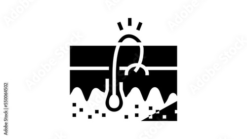 ingrowing hair glyph icon animation