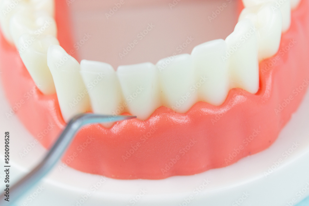 Fototapeta premium False teeth, jaws. Dentistry instruments and dental hygienist checkup concept Regular checkups are essential to oral health. Orthodontic tools, brace, bracket system, tooth,