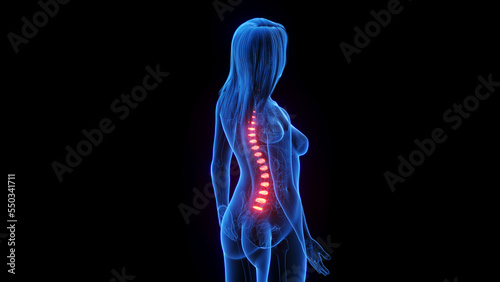 3d rendered medical illustration of a woman's intervertebral disc photo