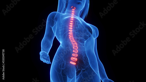 3d rendered medical illustration of a woman's intervertebral disc