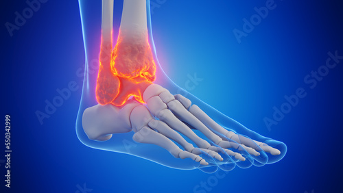 Foto 3d rendered medical illustration of a man's ankle