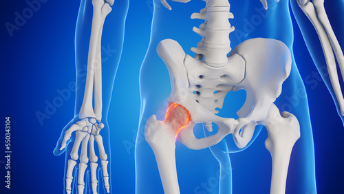 3d rendered medical illustration of a man's hip joint