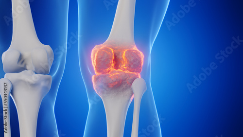 3d rendered medical illustration of a man's knee