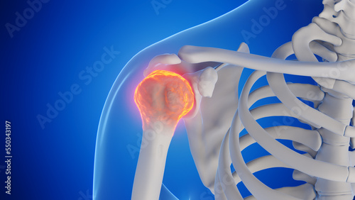 3d rendered medical illustration of a man's shoulder joint photo